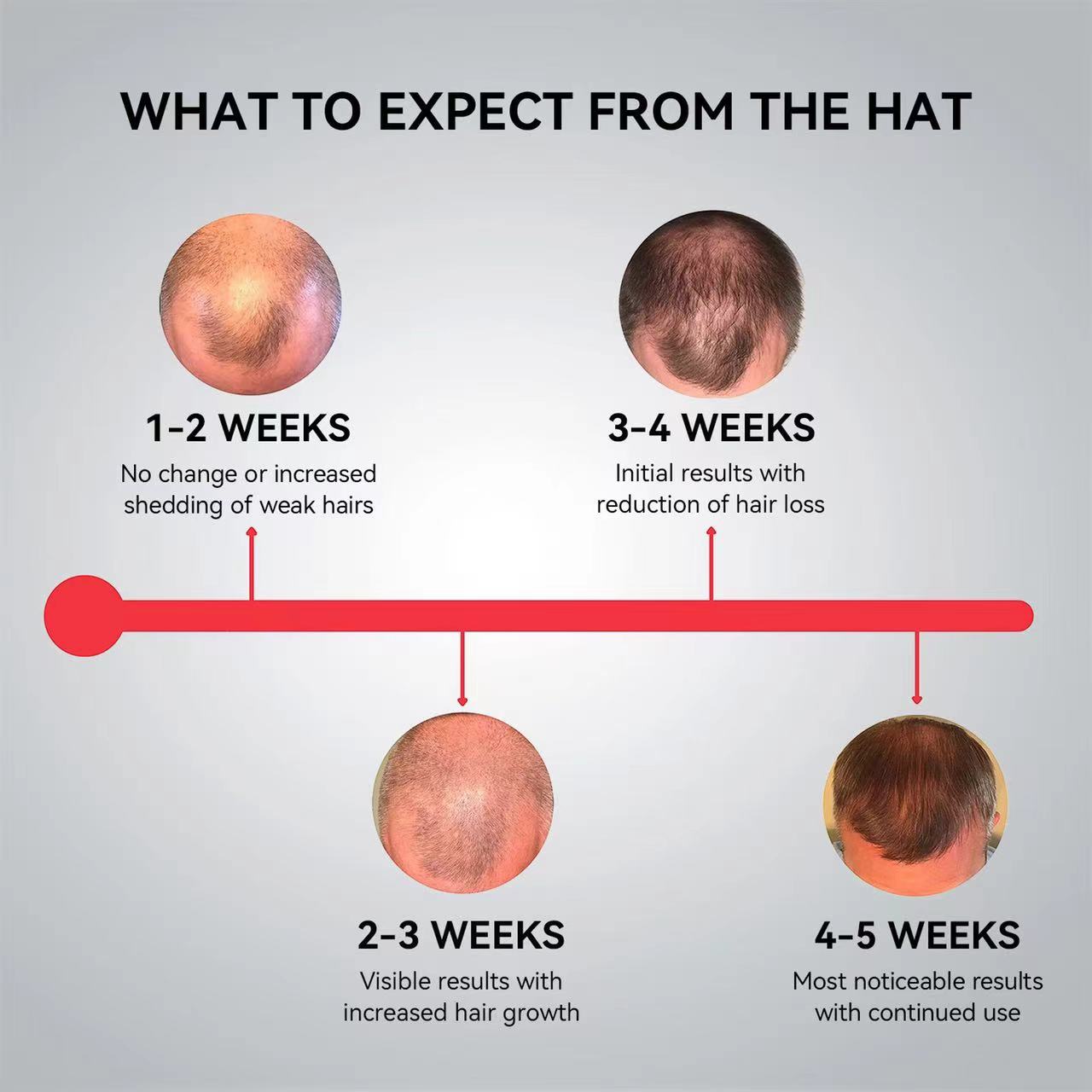 Megelin LED Cap For Hair Growth